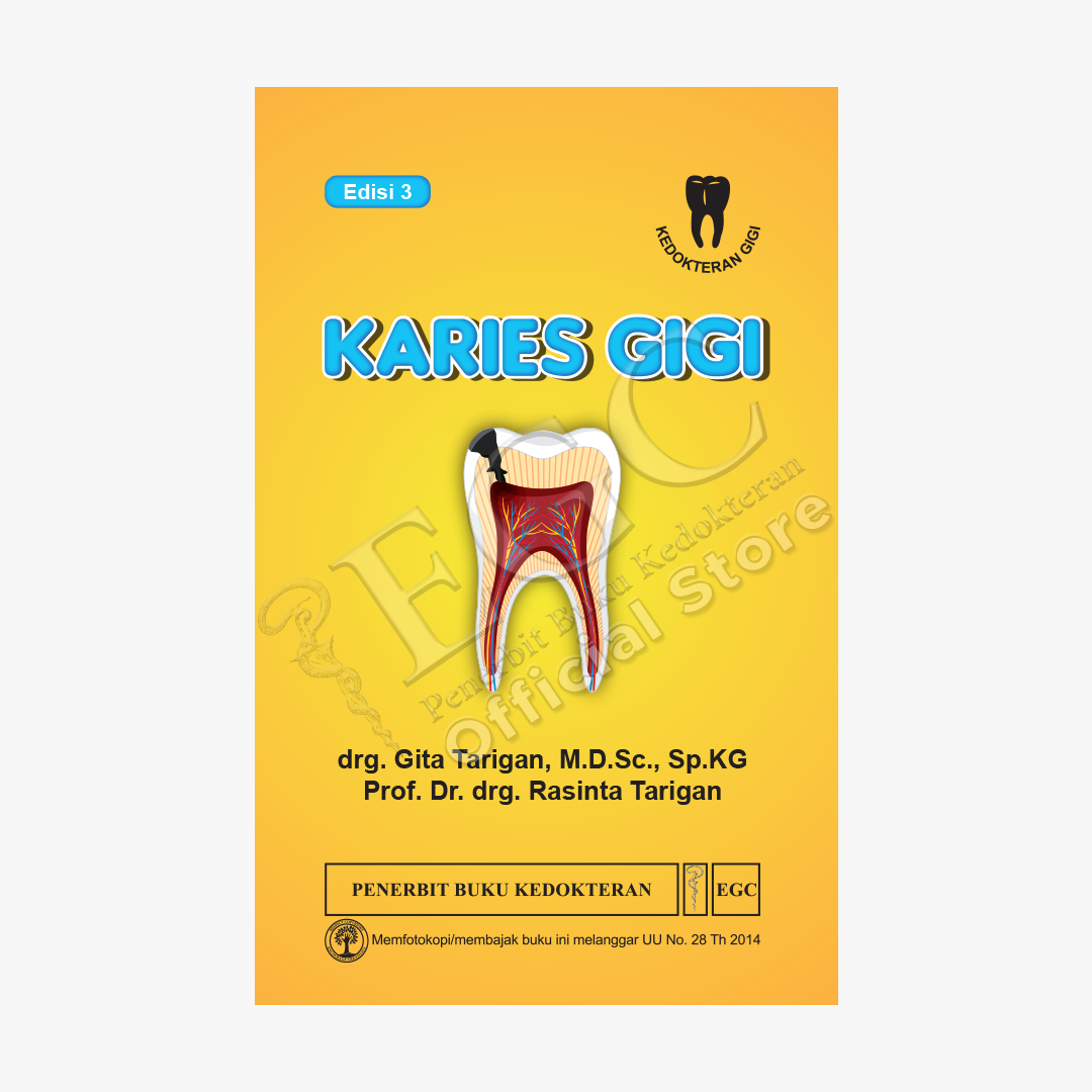 Karies Gigi