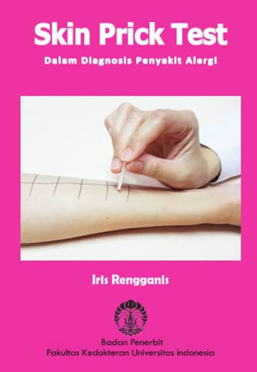 Skin Prick Test; Dalam Diagnosis Penyakit Alergi