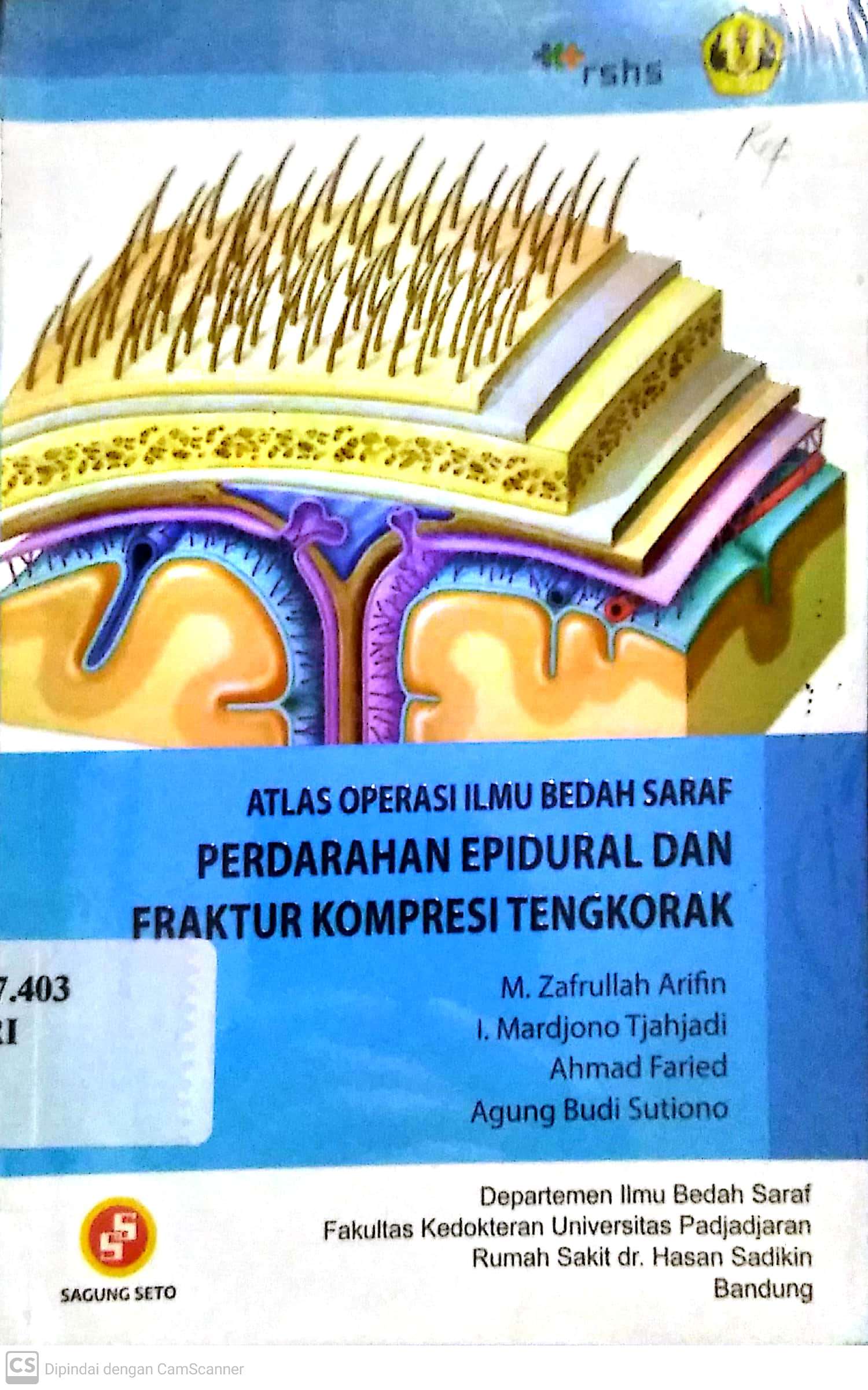 ATLAS OPERASI ILMU BEDAH SARAF PERDARAHAN EPIDURAL DAN FRAKTUR KOMPRESI TENGKORAK
