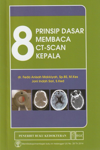 8 Prinsip Dasar Membaca CT-SCAN Kepala