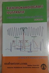 Elektrokardiografi Ilustratif; Belajar EKG Dengan Ilustrasi Sederhana