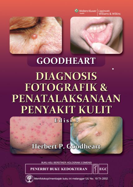 Diagnostik Fotografik & Penatalaksanaan Kulit