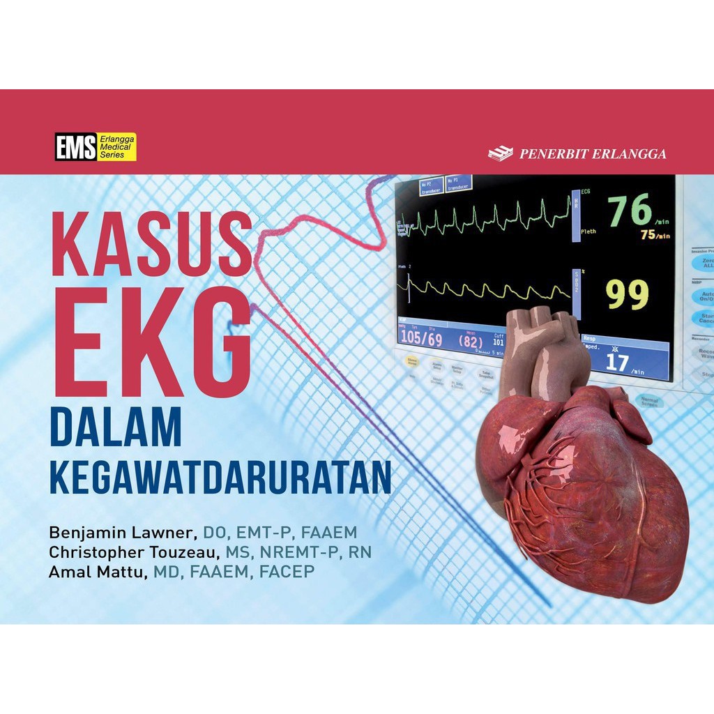 KASUS EKG DALAM KEGAWADARURATAN